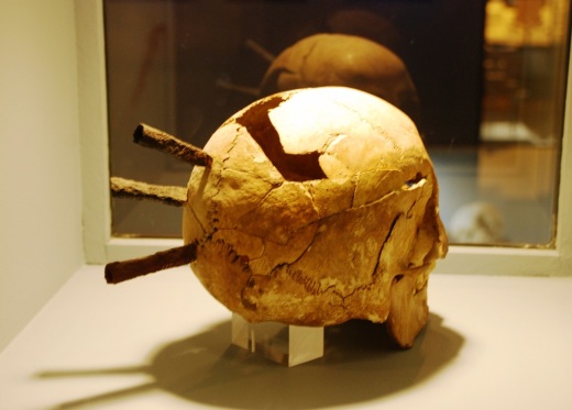 A skull from the battle of Gotland.